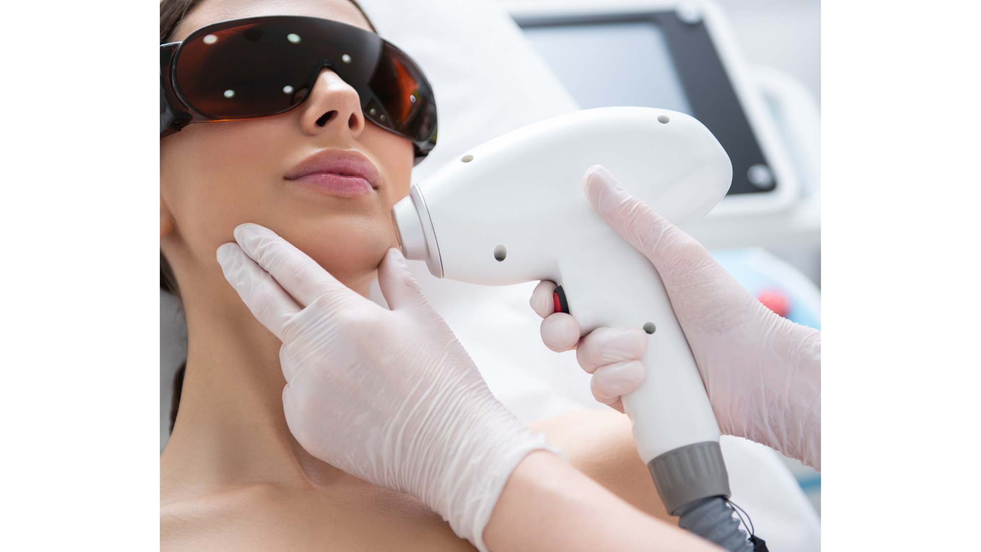 Pack de 5 sessões em 3 áreas de Depilação a Laser Feminina