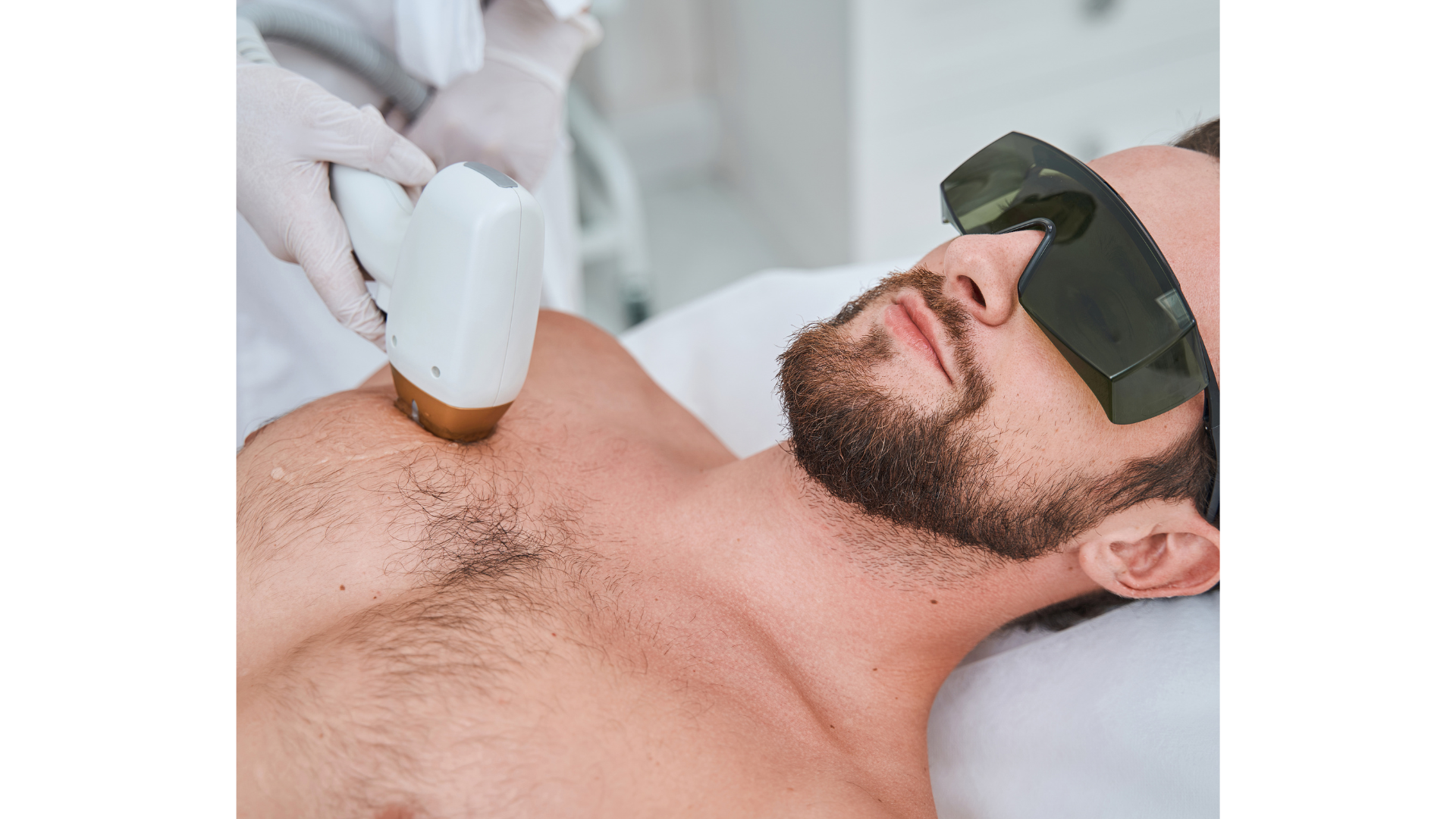 Pack de 5 sessões em 3 áreas de Depilação a Laser Masculina