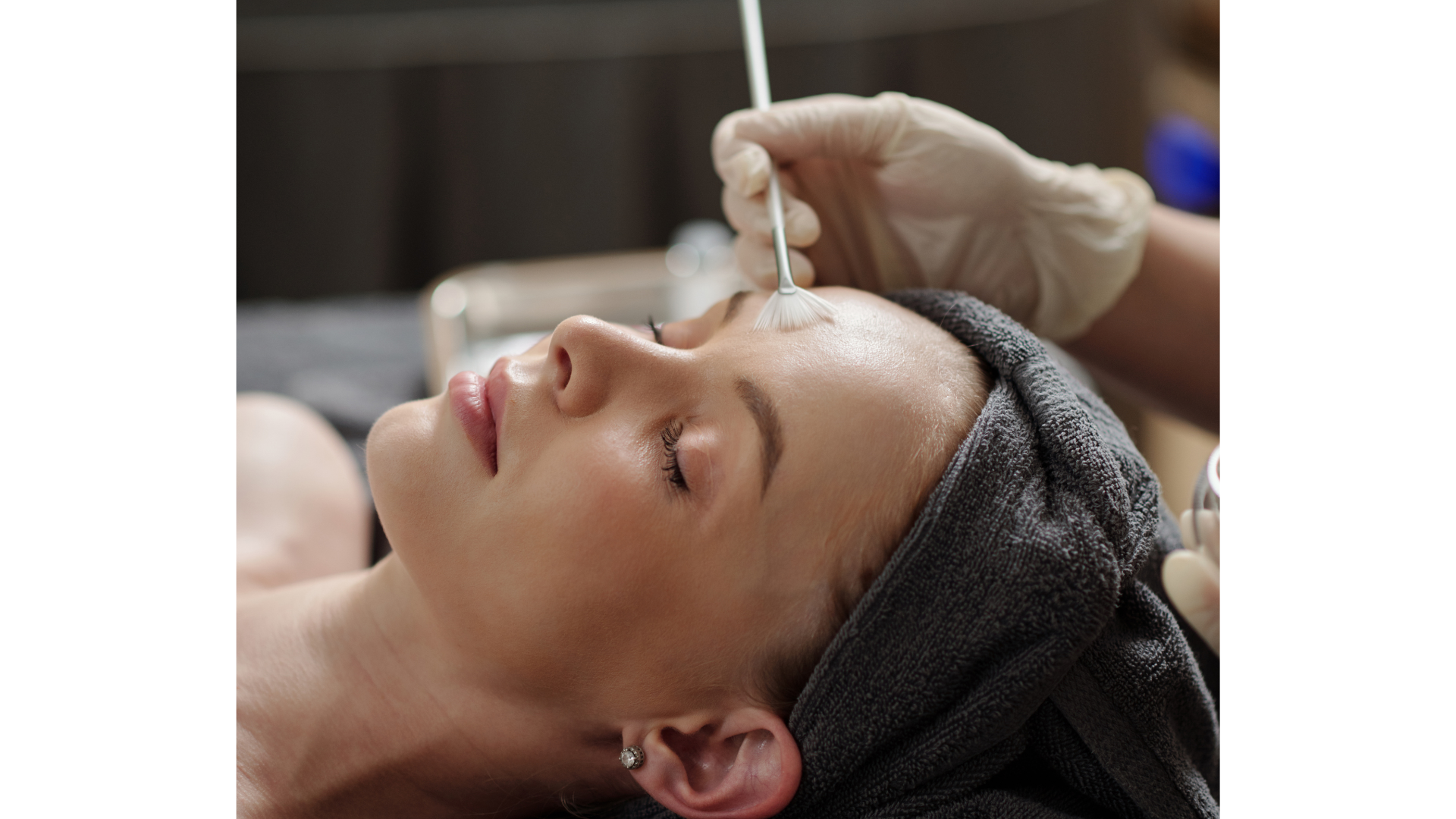 Peeling Químico Renovador